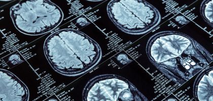 Diagnostic Imaging Investment