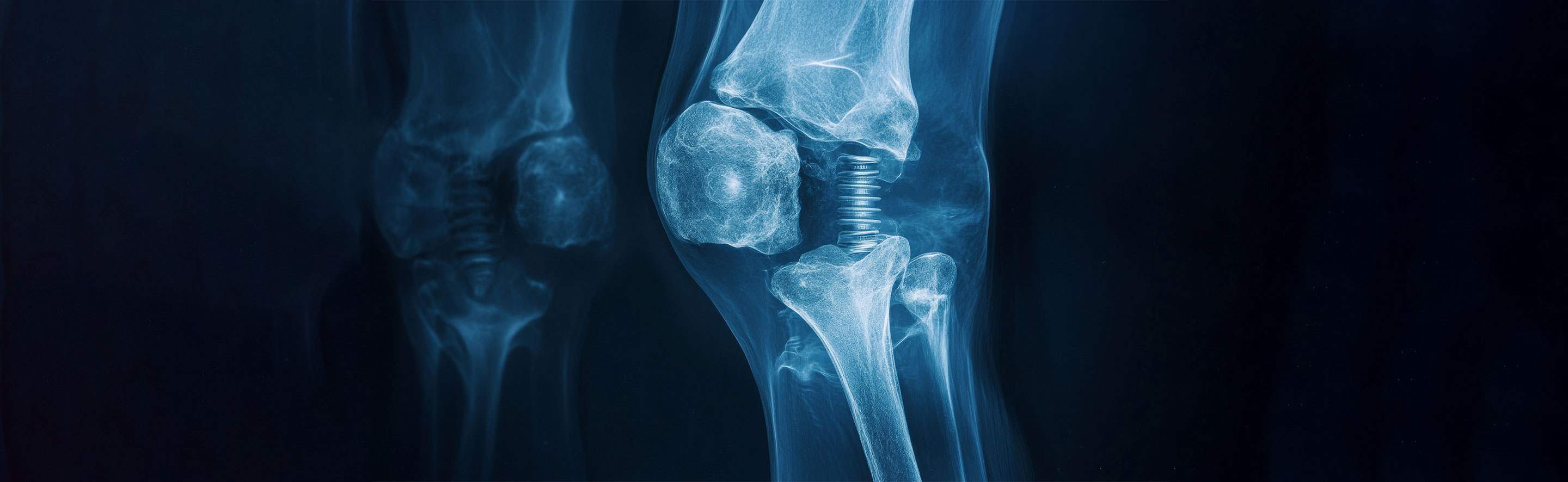 Transforming Medical Device Life Cycles: Unveiling the Power of ISO 10993-1's Upcoming Revision for Biological Evaluation