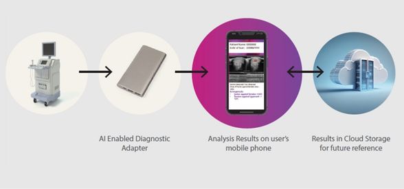 AI-Powered Diagnostic Solution for Musculoskeletal Injury Assessment by Tata Elxsi