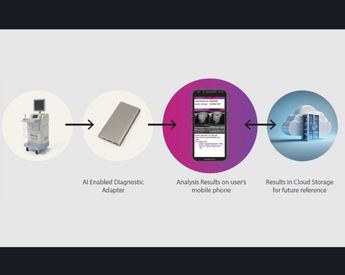 AI-Powered Diagnostic Solution for Musculoskeletal Injury Assessment by Tata Elxsi