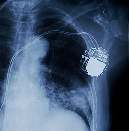 Biological Equivalence: Streamlining Medical Device Testing with the Proposed ISO 10993-1 Revision