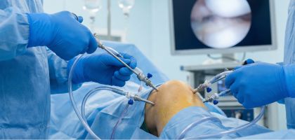 Surgical Video Monitoring - AI in Analytics